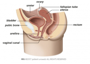 Urethral sounding story
